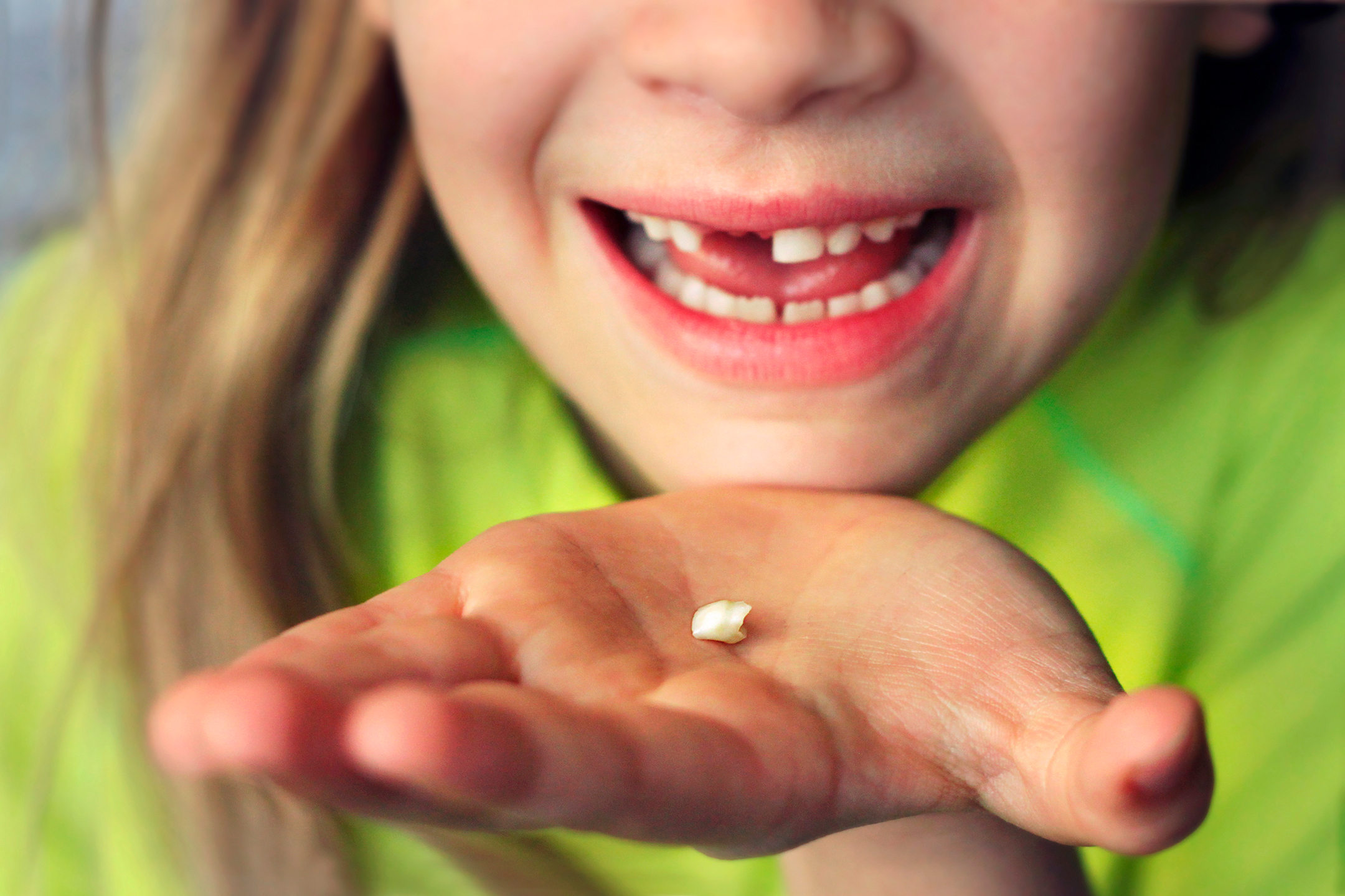 Closeup of a baby tooth held in the hand of a girl. In the background the smiling girl, where you can see a missing tooth. 