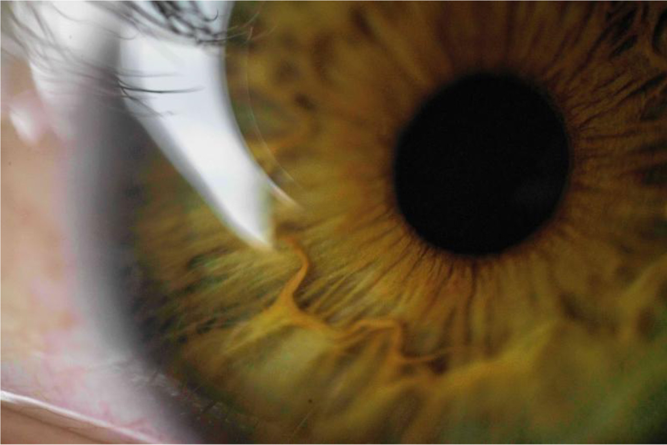 Close-up photograph of an eye